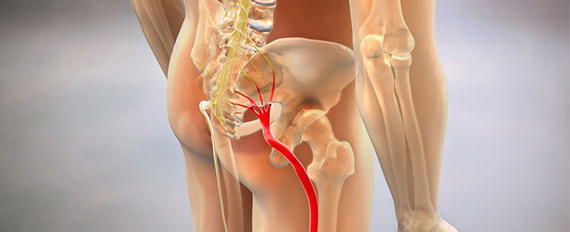 Diagram of sciatic nerve